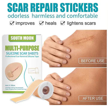 The Benefits of Silicone Sheets for Scar Management